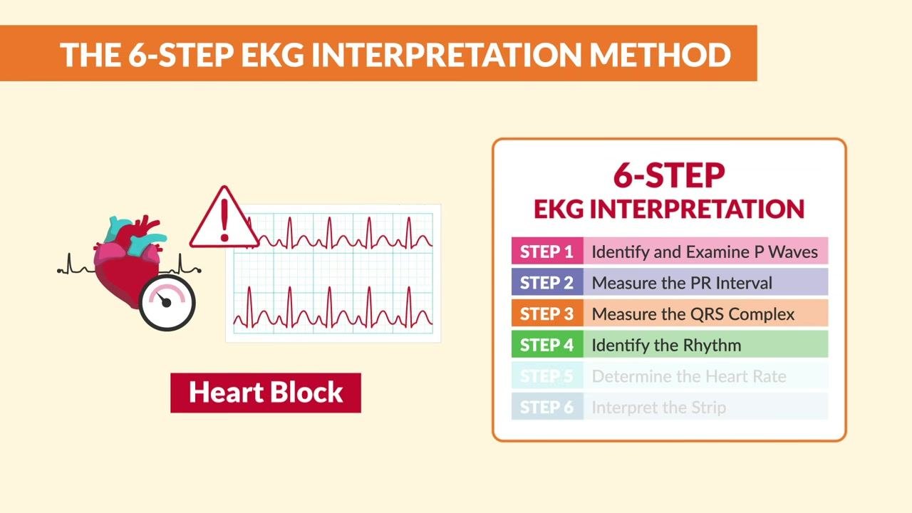 A heart illustration, an EKG strip with an irregular rhythm, a warning icon, and a "Heart Block" label appear alongside the six-step method with Step 4 highlighted.