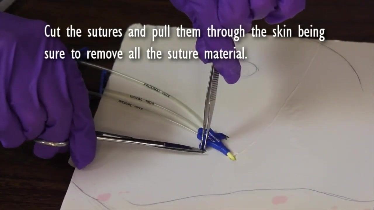 Nurse removing gloves and washing hands before applying sterile gloves.
