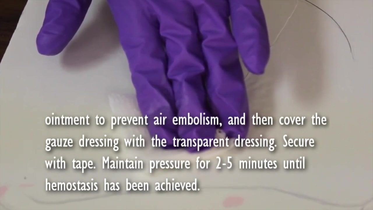 Gloved hand maintaining firm pressure over the occlusive dressing, with the transparent dressing visible over the site.