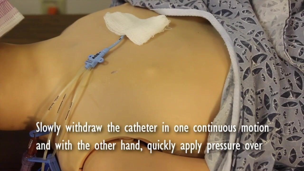 Sterile gauze with ointment being applied to the insertion site immediately after the catheter is withdrawn.