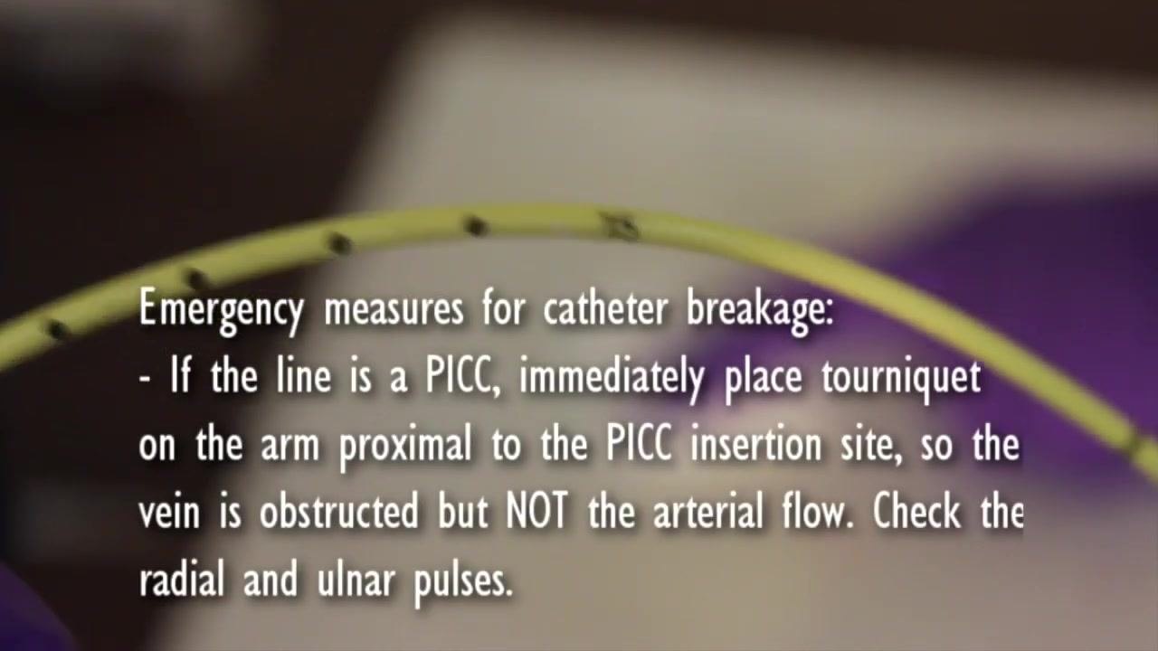 Close-up of a catheter with on-screen guidance describing emergency measures for catheter breakage, including tourniquet placement and pulse checks.