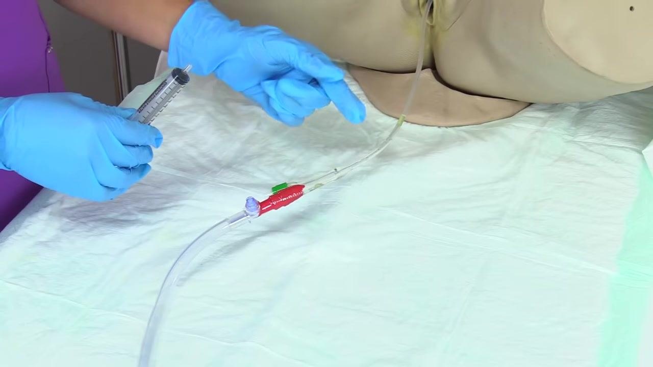 Gloved hands holding the syringe connected to the balloon port, ready for deflation