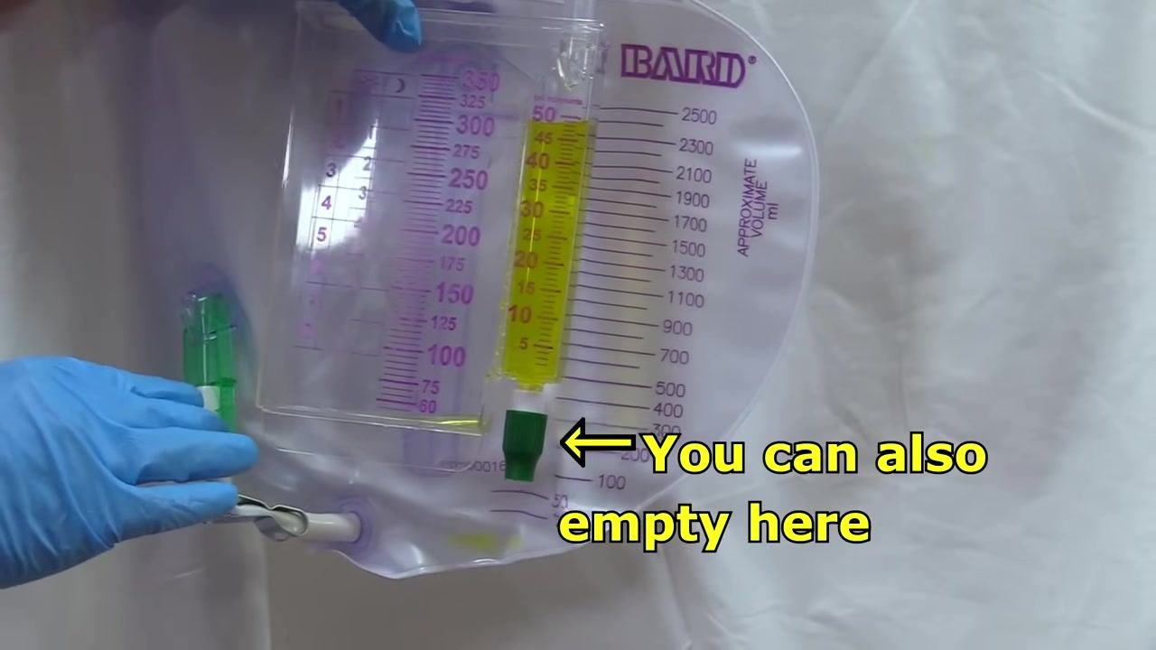 Close-up of a Foley catheter urine collection bag with measurement markings, a gloved hand pointing to the drainage port, and the on-screen note: You can also empty here