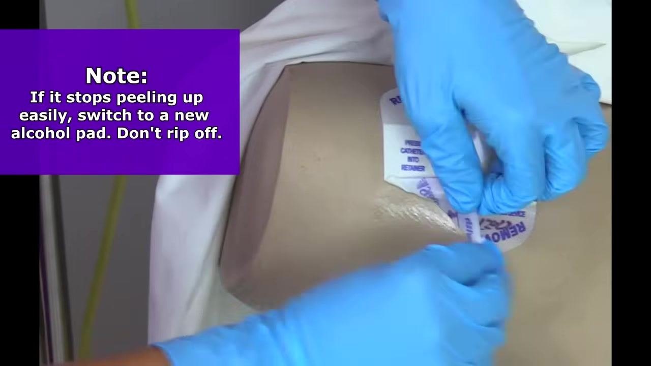 Gloved hands gently peeling up the securement device with an alcohol pad, next to the note: If it stops peeling up easily, switch to a new alcohol pad. Don't rip off