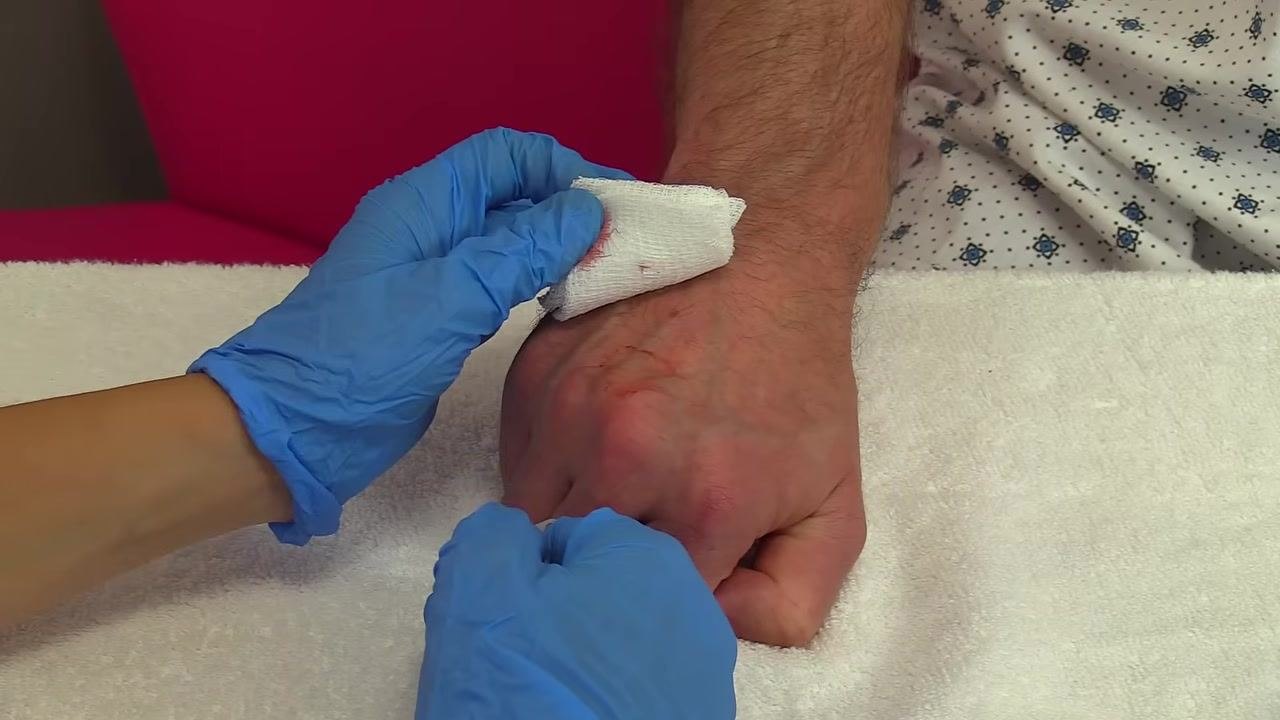 Gloved hands holding gauze with firm pressure over the IV site on a patient's hand, cannula and tape visible, patient in hospital gown