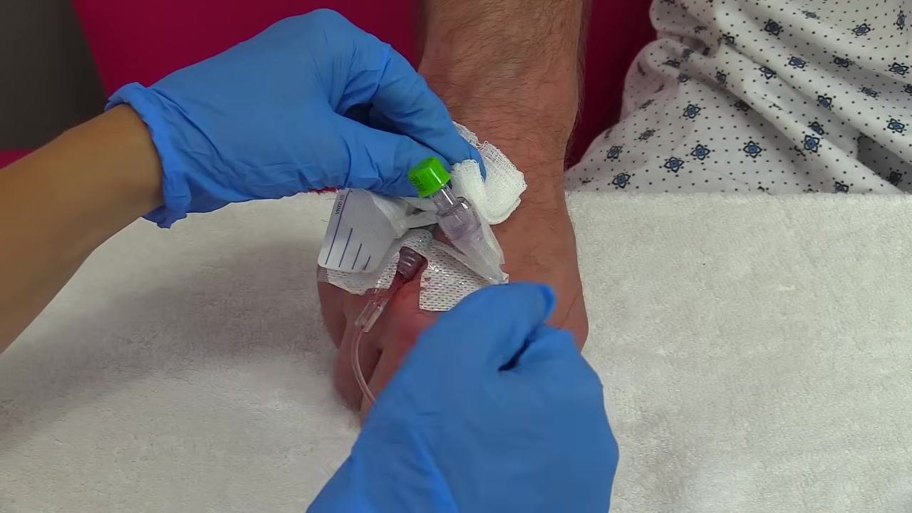 Gloved hands applying pressure to the IV site with gauze after cannula removal