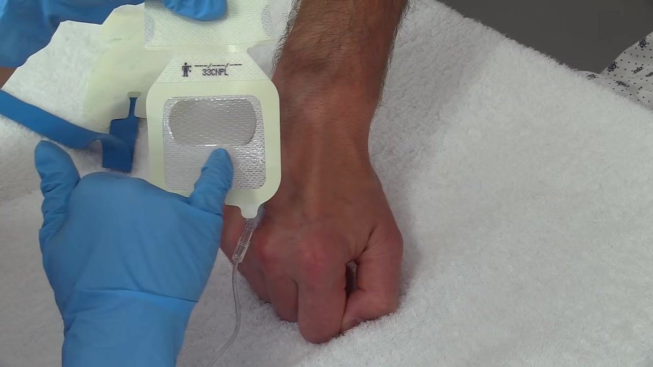 Positioning a transparent dressing with a notched area labeled "33CNPL" above the IV site on the back of the patient's hand; the catheter and tubing are visible and the hand rests on a white towel