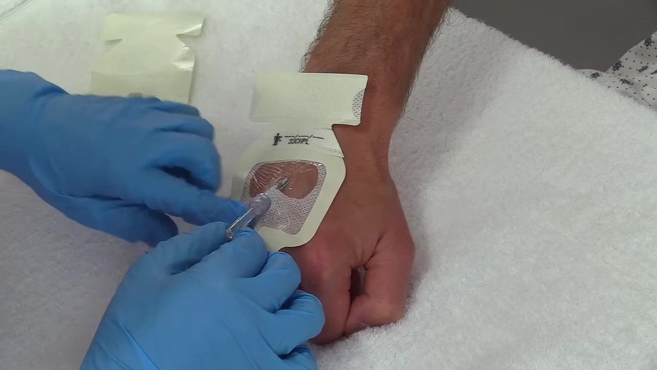 Adjusting the dressing around the IV catheter to ensure the notched area fits securely