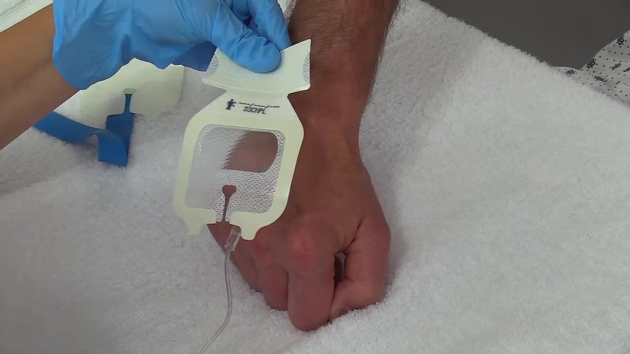 Lifting the IV tubing while adjusting the dressing so the notched parts fit underneath the tubing