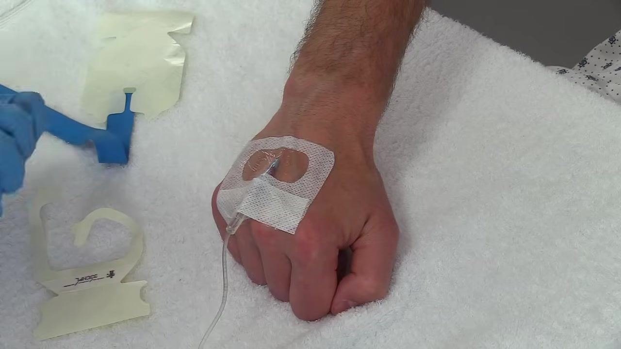 The IV site fully secured with the dressing and secondary strip; the tubing is arranged in a "J" shape and secured to the hand