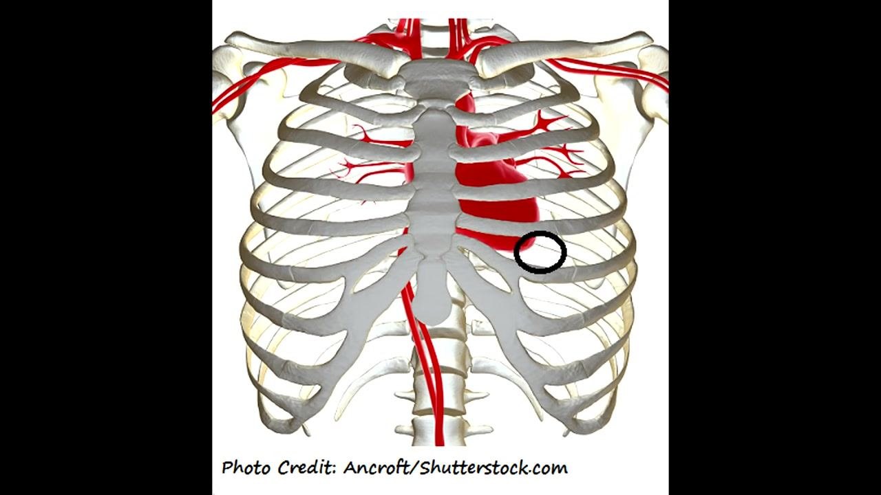 Anatomical diagram of the rib cage and heart, with the apical pulse location circled at the fifth intercostal space, midclavicular line