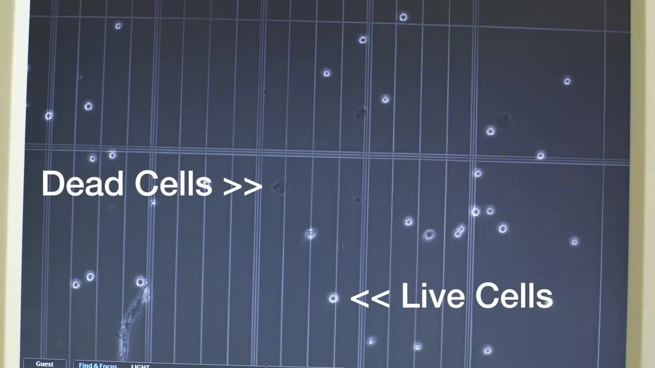Close-up of a microscope display screen labeled "Dead Cells >>" and "<< Live Cells" with cells visible on a grid