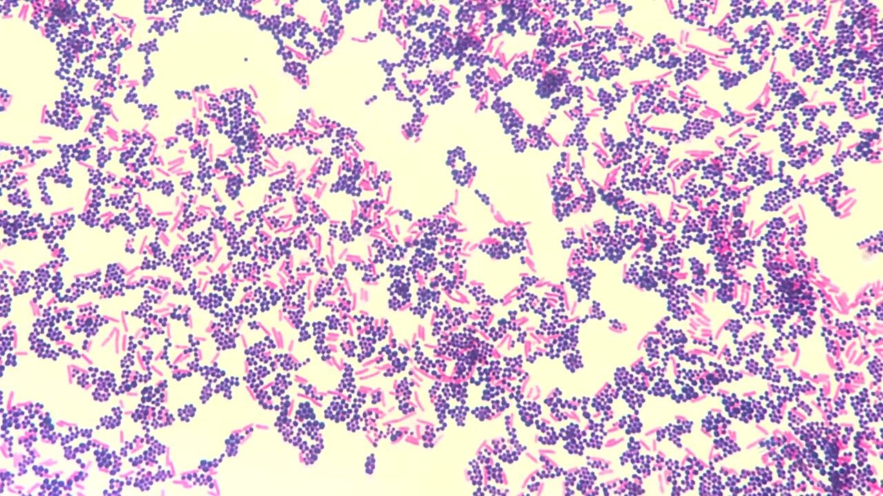 Title screen showing "HARDY DIAGNOSTICS: Gram Stain Tutorial - How to prepare a perfect Gram Stain"