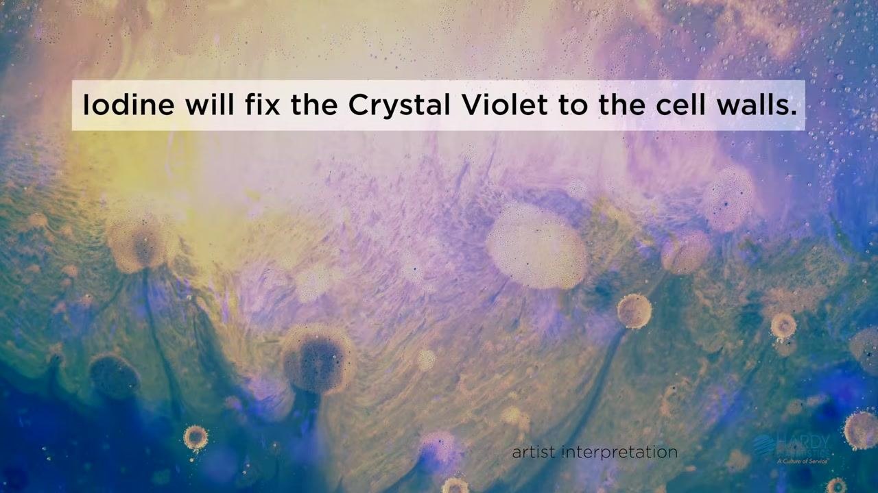 Artistic interpretation with blue and yellow hues, on-screen text: "Iodine will fix the Crystal Violet to the cell walls."