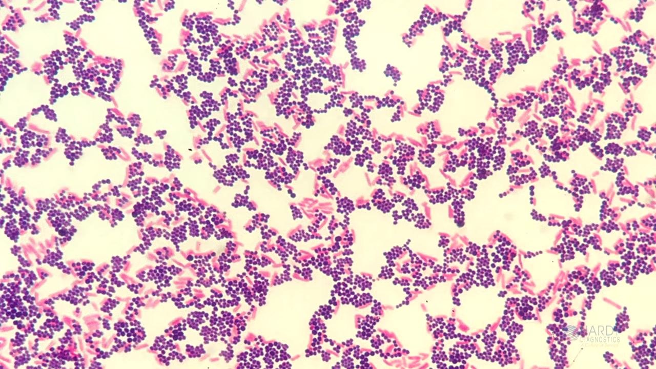 Microscope image showing clusters of purple cocci (gram-positive) and pink rods (gram-negative) on a light background
