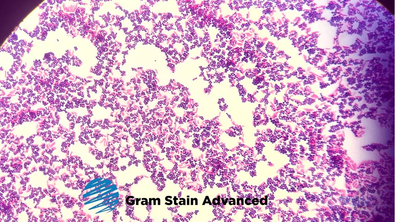 Microscope image showing clusters of purple cocci (Staphylococcus aureus, Gram-positive) and pink rods (Gram-negative), with a petri dish and label "Staphylococcus aureus"