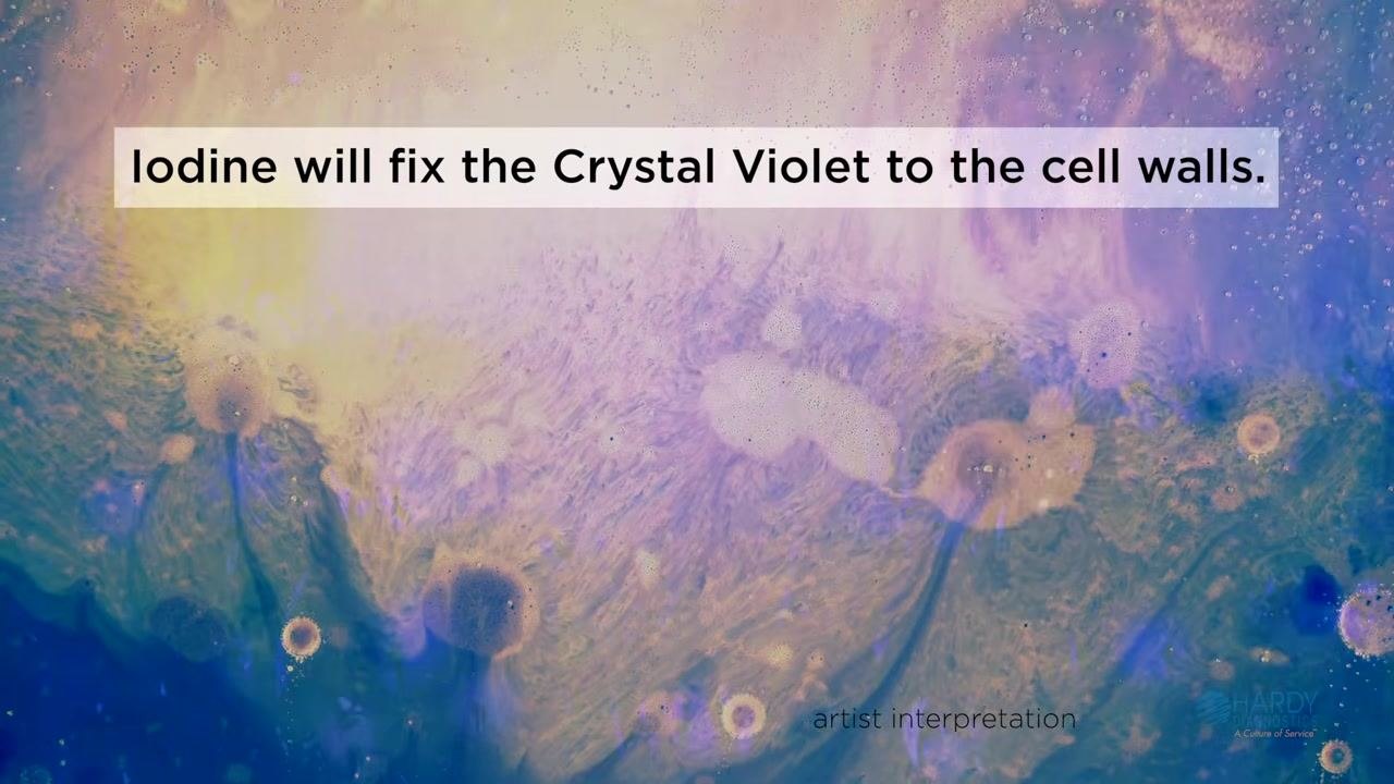 Artistic interpretation with blue and yellow hues. On-screen text: "Iodine will fix the Crystal Violet to the cell walls."