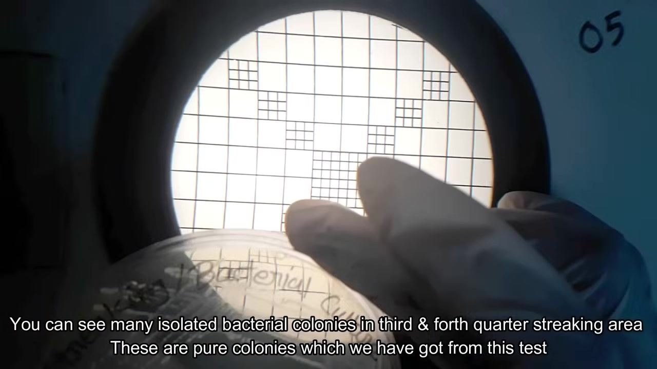A gloved hand holding a petri dish with isolated colonies over a grid background.