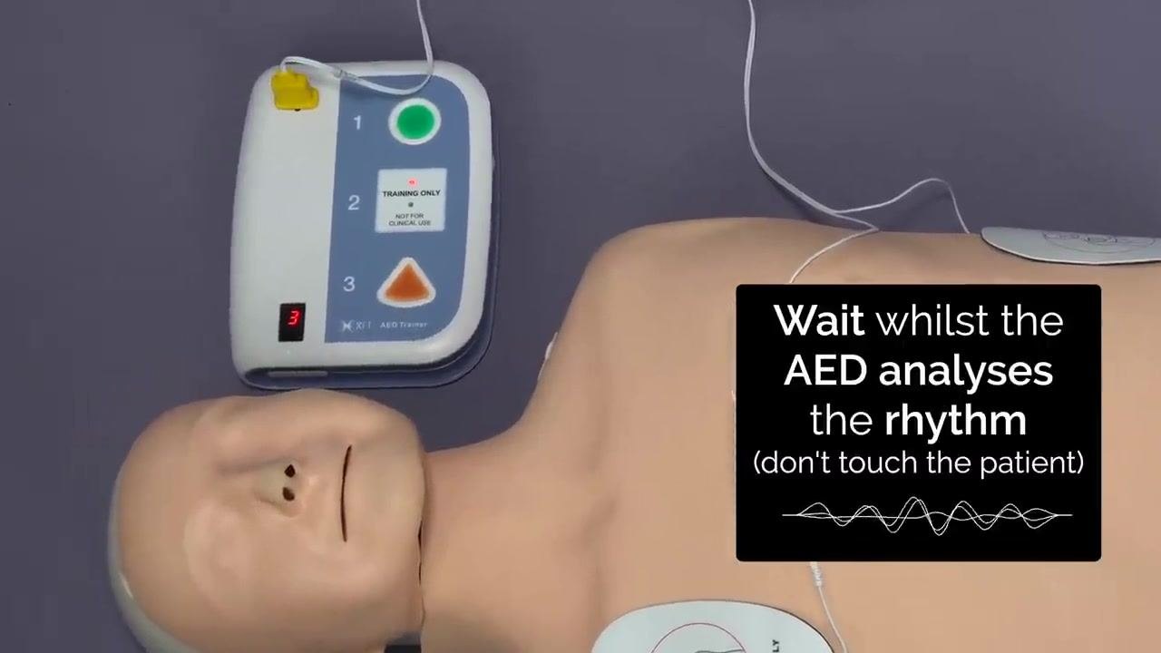 Pads applied to a mannequin in correct positions, AED connected, with labels "Left mid-axillary line" and "Right infraclavicular area"